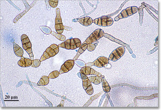 mikotoksini03